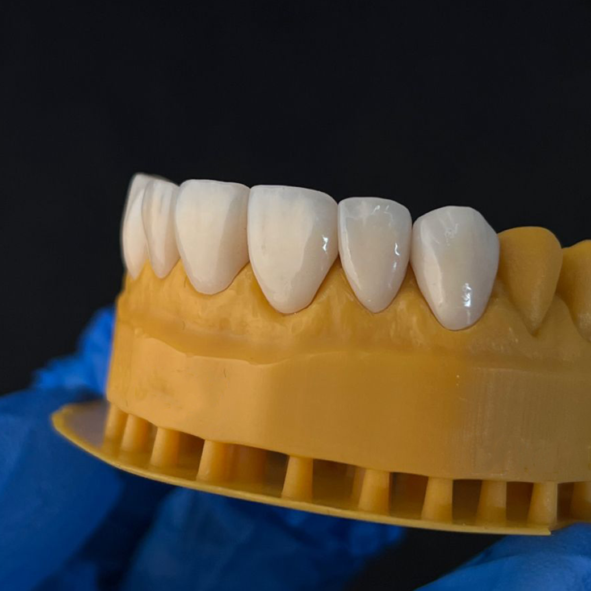 The Art of Finishing: Achieving a Lifelike Surface on Zirconia and Glass-Ceramics