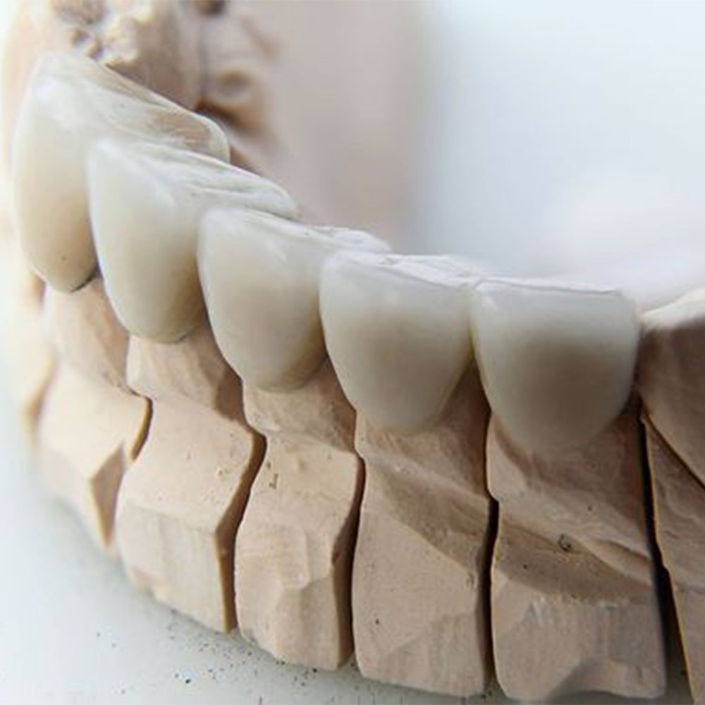 Effect of ceramic type and thickness on the masking ability of chairside machinable all-ceramic crowns
