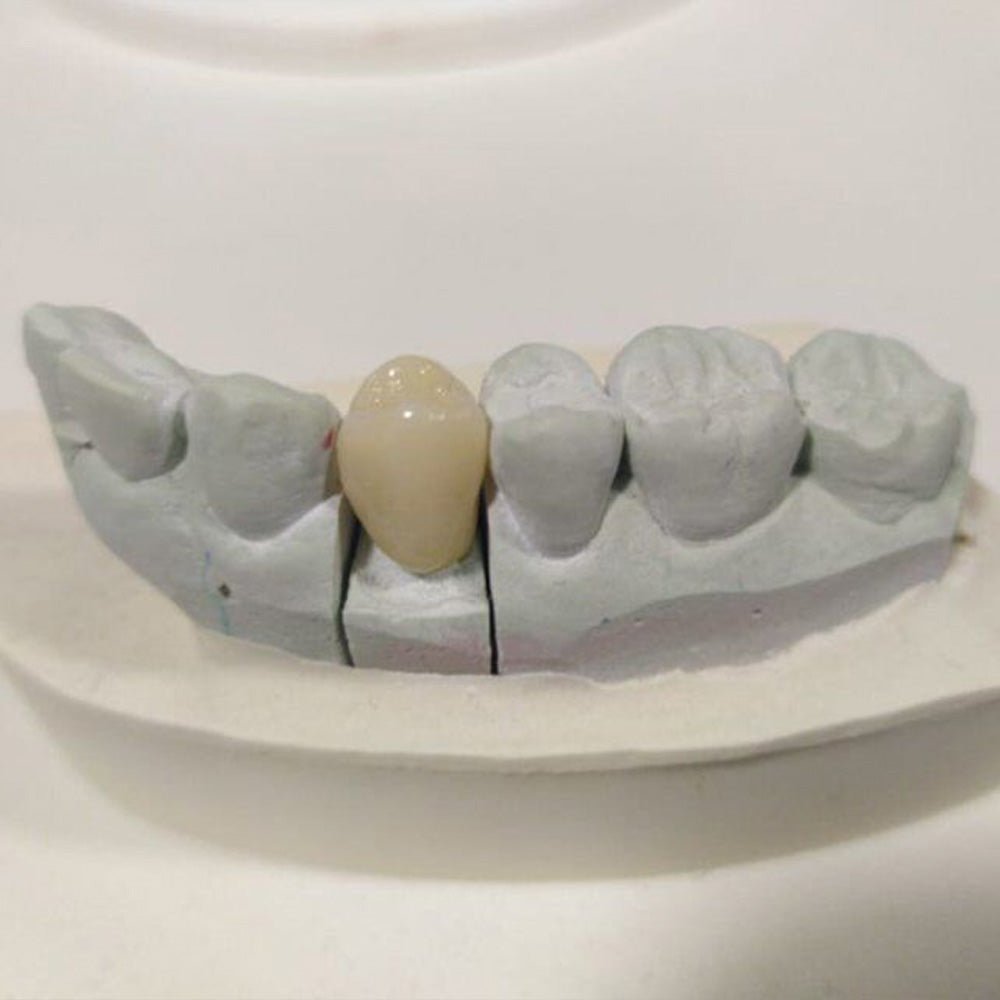 An In-depth Insight into Orthodontic Dental Laboratories - CeraDirect