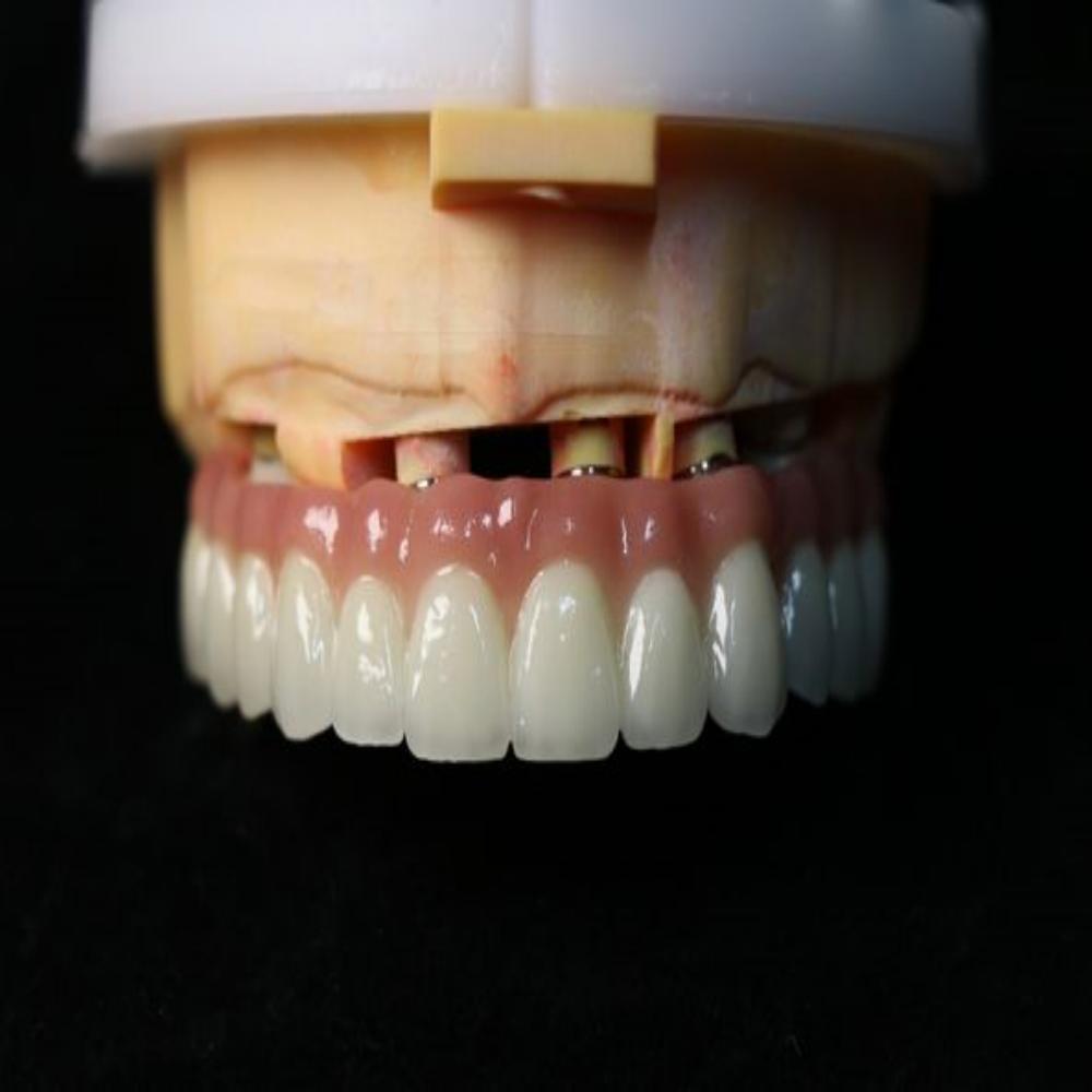 Why is dental zirconia recommended? - CeraDirect