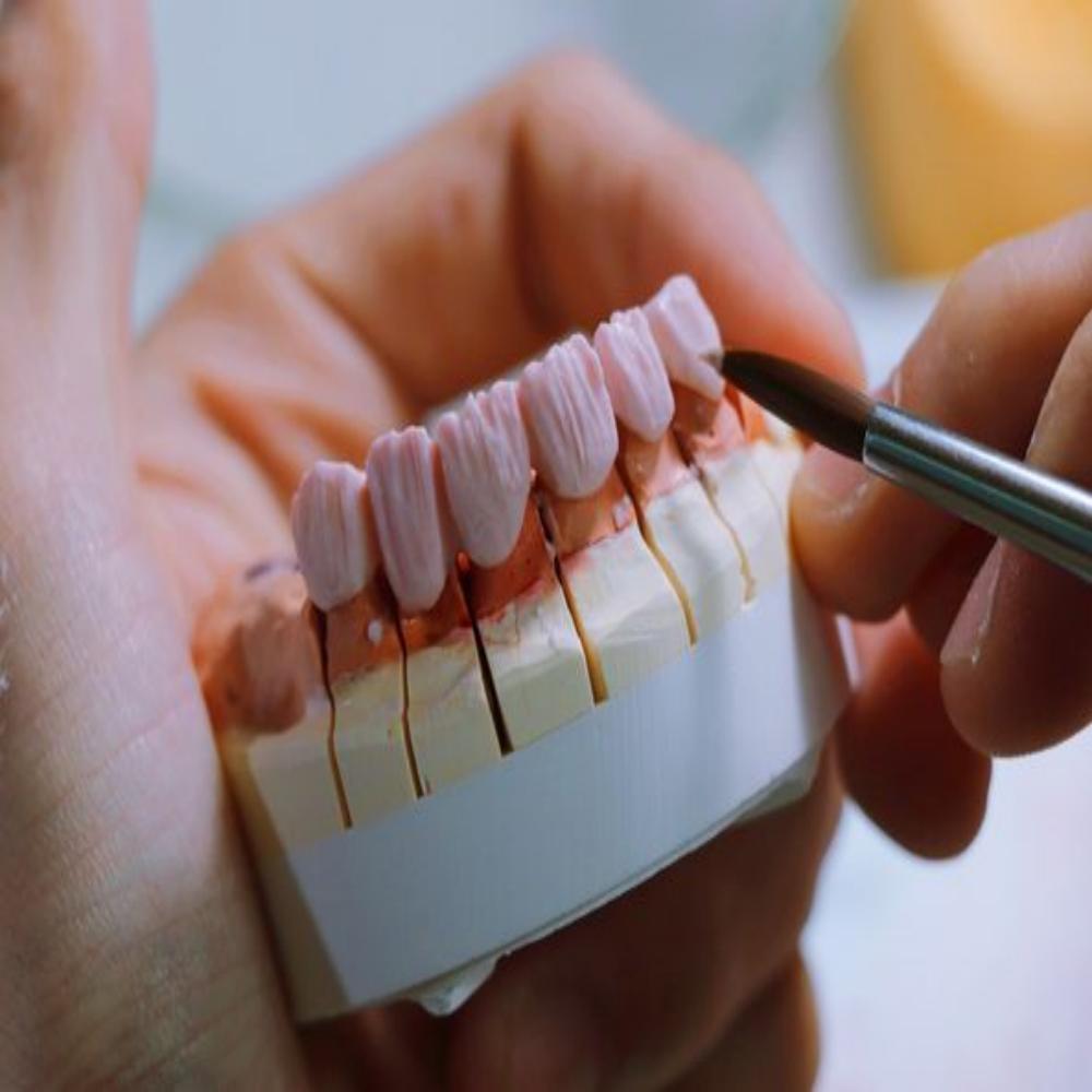 Zirconia Dental Materials - Market Status and Future Development Trends - CeraDirect