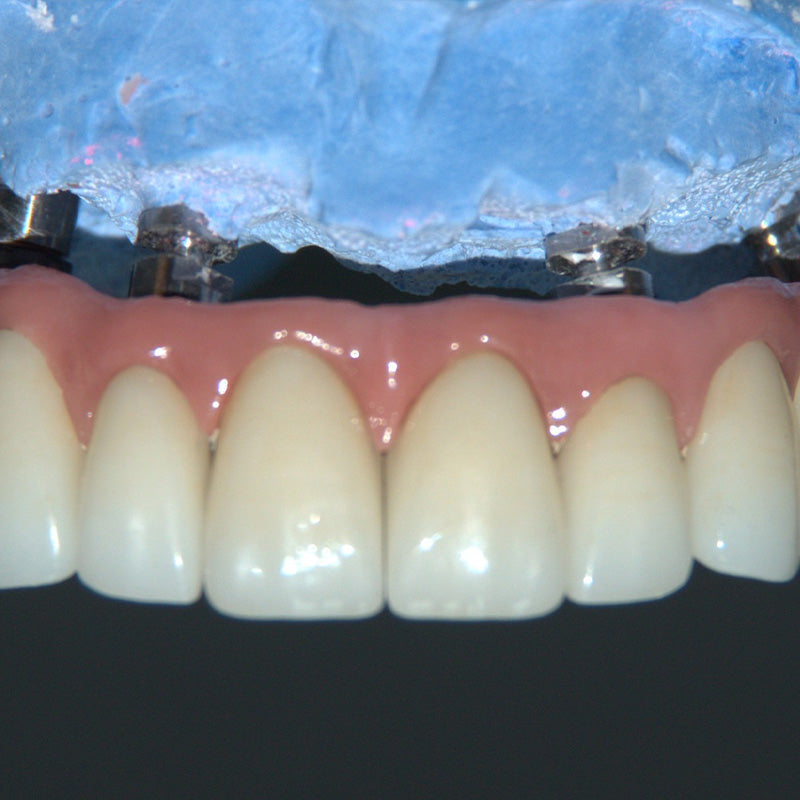 A Revolution in Dentistry: The Innovative Solutions of Sirona CEREC InLab Dental CAD/CAM
