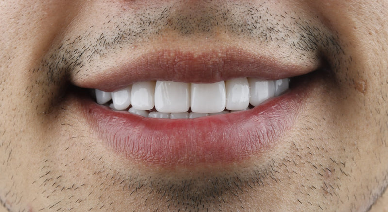 Lithium disilicate dental implant