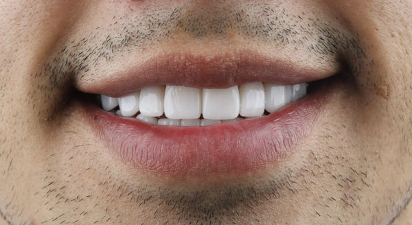 Lithium disilicate dental implant - CeraDirect