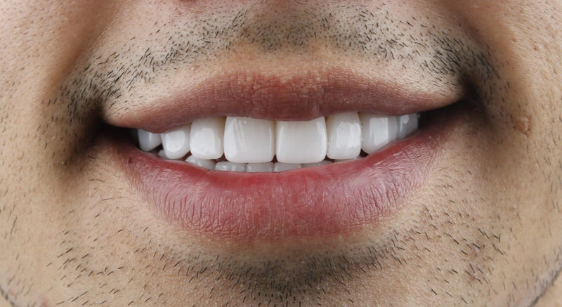 Lithium disilicate dental implant - CeraDirect