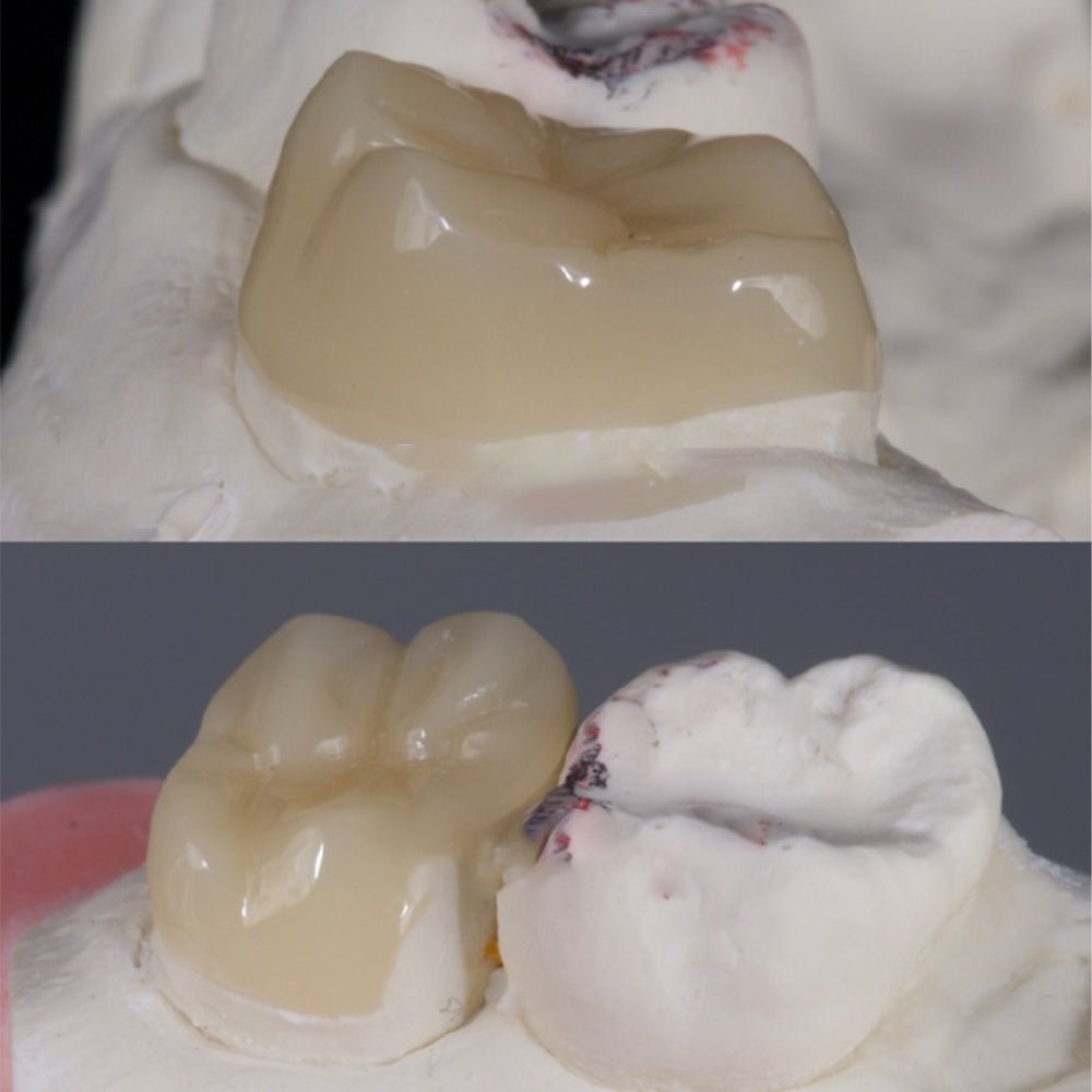 Multilayer Ceramic Components Hybrid Ceramic Multilayer—HT(5 pieces) | Ceradirect