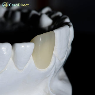 SHT+Color — Pre-shaded Zirconia Disc AG System (71mm) - CeraDirect